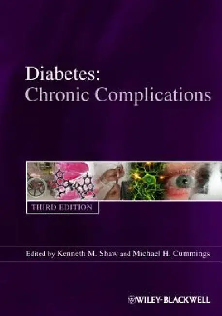 Diabetes Chronic Complications by Kenneth M. Shaw