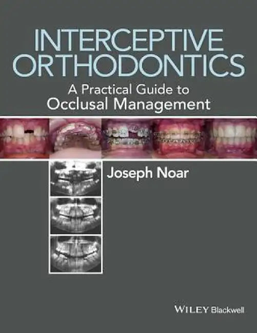Interceptive Orthodontics: A Practical Guide to Occlusal Management by Joseph Noar