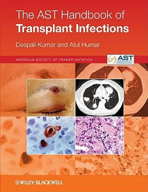 The Ast Handbook of Transplant Infections by Deepali Kumar