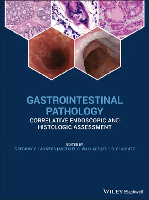GI Pathology and Endoscopic Biopsy: A Clinical Guide to Diagnosis by Gregory Y. Lauwers