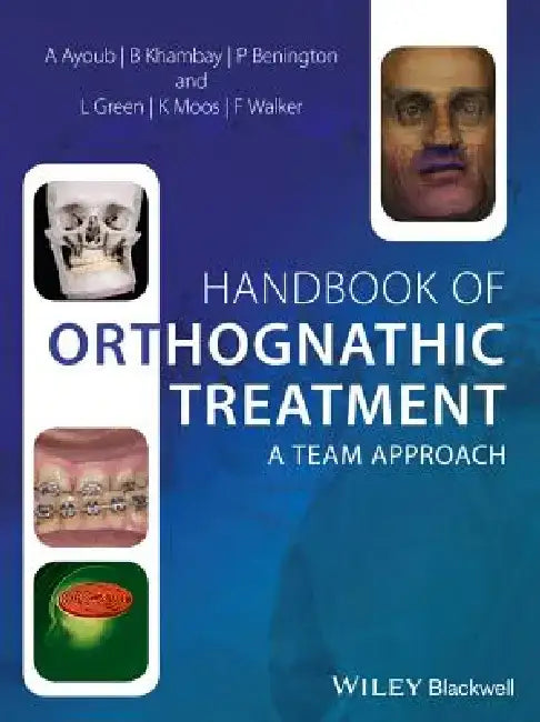 Handbook of Orthognathic Treatment: A Team Approach by Ashraf Ayoub