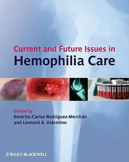 Current and Future Issues in Hemophilia Care by Em Rito Carlos Rodr Guez-Merch N.