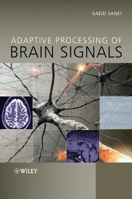 Adaptive Processing of Brain Signals by Saeid Sanei