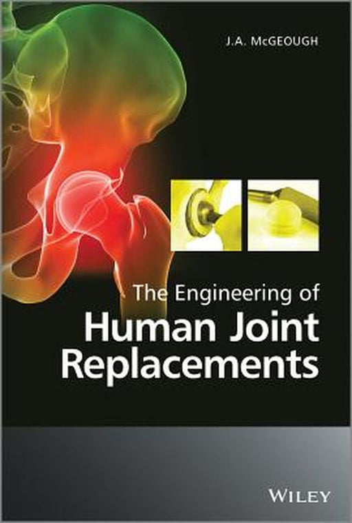 The Engineering Of Human Joint Replacements by Joseph McGeough