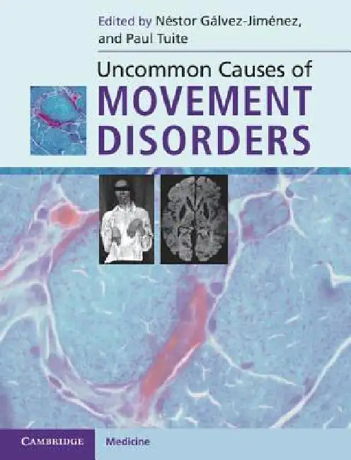 Uncommon Causes of Movement Disorders by Néstor Gálvez-Jiménez, Paul Tuite