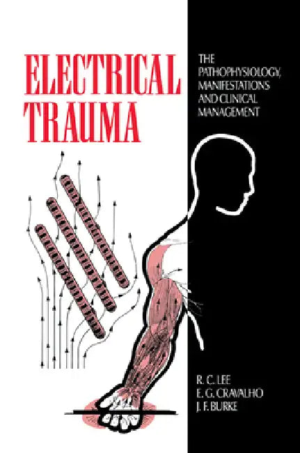 Electrical Trauma: The Pathophysiology, Manifestations and Clinical Management by R. C. Lee, E. G. Cravalho, J. F. Burke