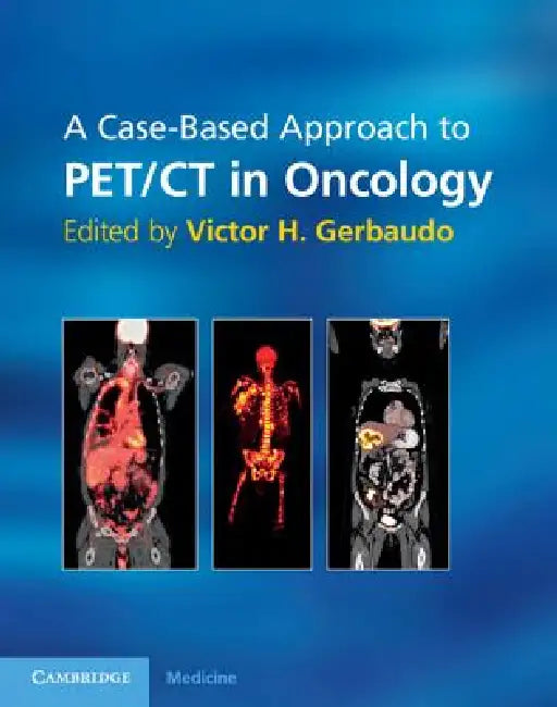 A Case-Based Approach to Pet/CT in Oncology by Victor H. Gerbaudo