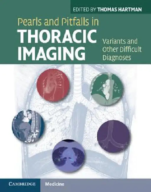 Pearls and Pitfalls in Thoracic Imaging: Variants and Other Difficult Diagnoses by Thomas Hartman