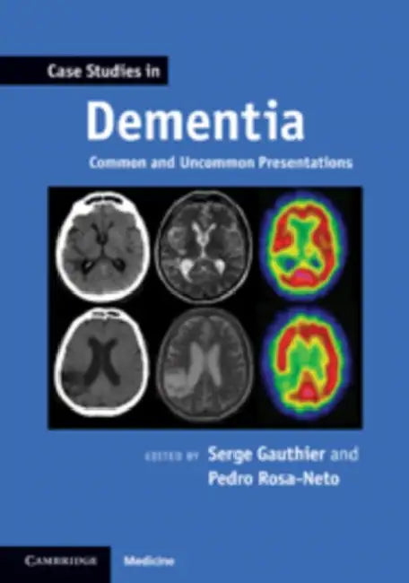 Case Studies in Dementia: Volume 1: Common and Uncommon Presentations by Serge Gauthier, Pedro Rosa-Neto