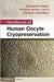 Handbook Of Human Oocyte Cryopreservation by Eleonora Porcu