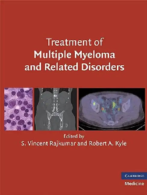 Treatment of Multiple Myeloma and Related Disorders by S. Vincent Rajkumar, Robert A. Kyle