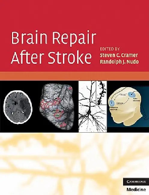 Brain Repair After Stroke by Steven C. Cramer, Randolph J. Nudo