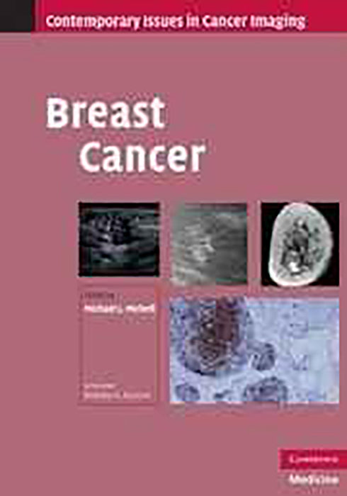 Breast Cancer  (9780521519502)