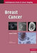 Breast Cancer by Michael J. Michell