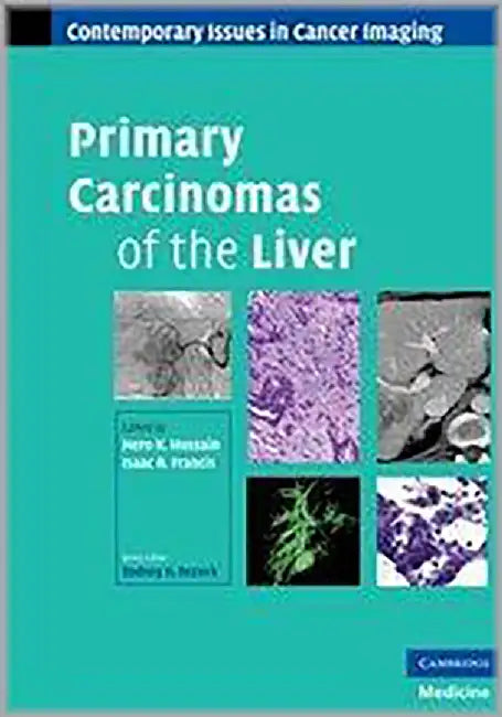Primary Carcinomas Of The Liver by Hero K. Hussain