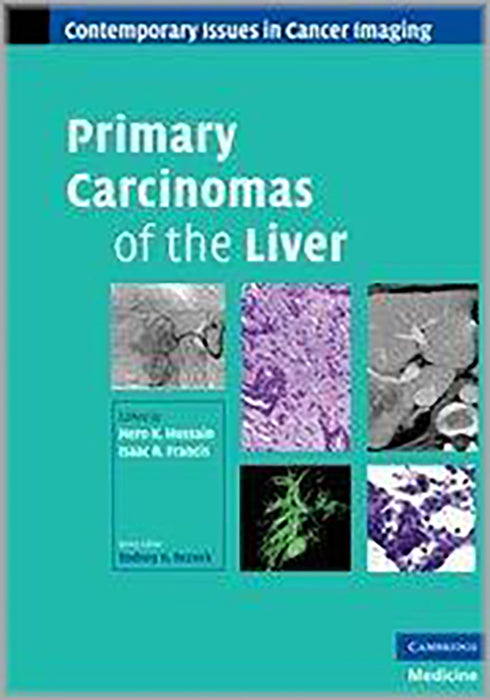 Primary Carcinomas Of The Liver