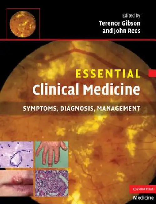 Essential Clinical Medicine: Symptoms, Diagnosis, Management by Terence Gibson, John Rees