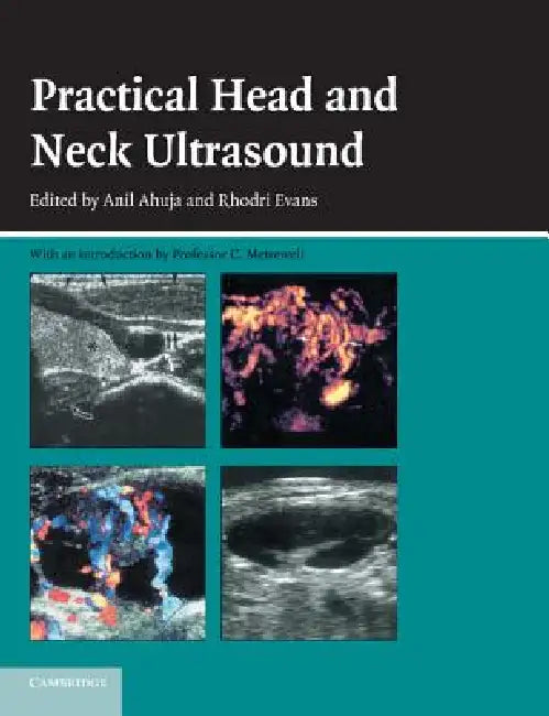 Practical Head & Neck Ultrasound by Anil T. Ahuja, Rhodri M. Evans