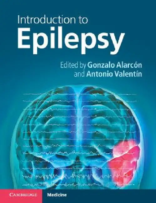 Introduction to Epilepsy by Gonzalo Alarcón, Antonio Valentín