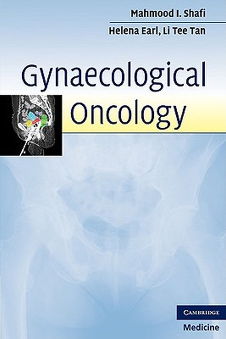 Gynaecological Oncology by Mahmood I. Shafi MD MRCOG