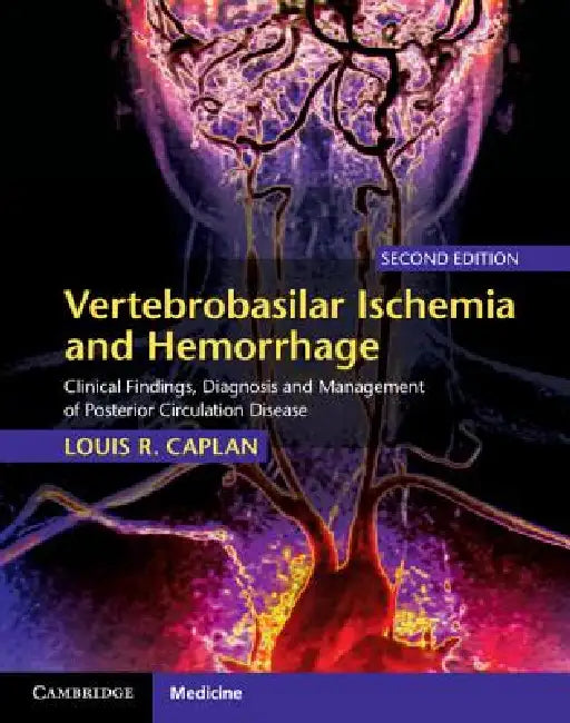 Vertebrobasilar Ischemia and Hemorrhage: Clinical Findings, Diagnosis and Management of Posterior Circulation Disease by Louis R. Caplan