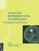 Assisted Reproductive Technology by Christopher J. de Jonge, Christopher L. R. Barratt