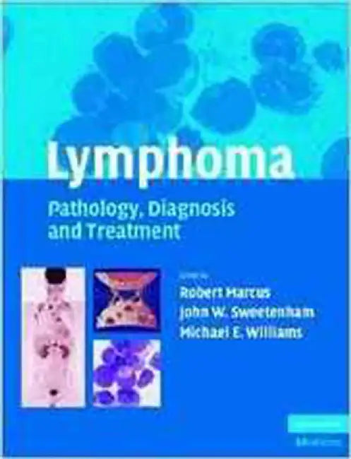 Lymphoma: Pathology, Diagnosis and Treatment by Dr Robert Marcus