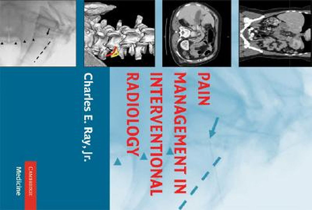 Pain Management In Interventional Radiology by Charles E. Ray Jr.