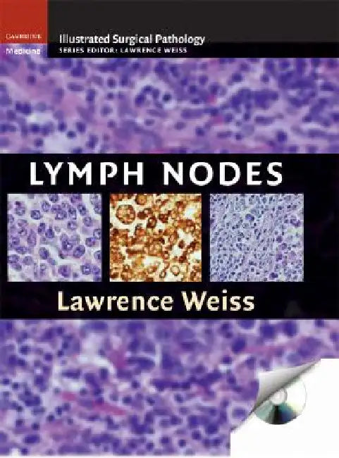 Lymph Nodes [With CDROM] by Lawrence M. Weiss