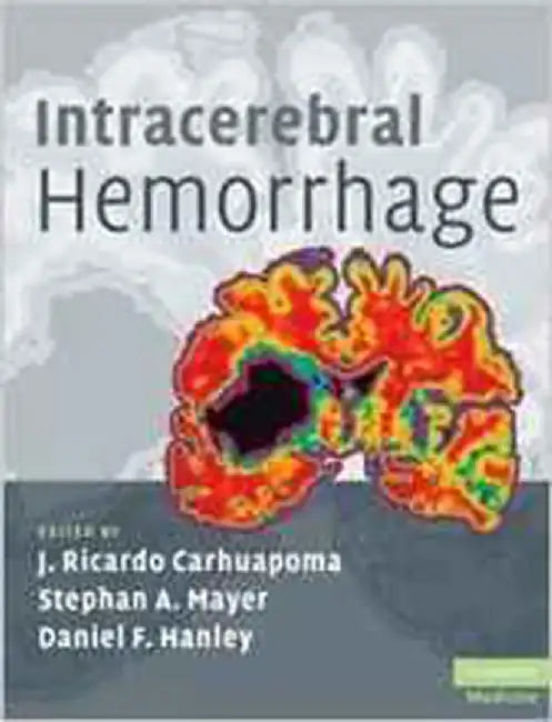 Intracerebral Hemorrhage by J. Ricardo Carhuapoma