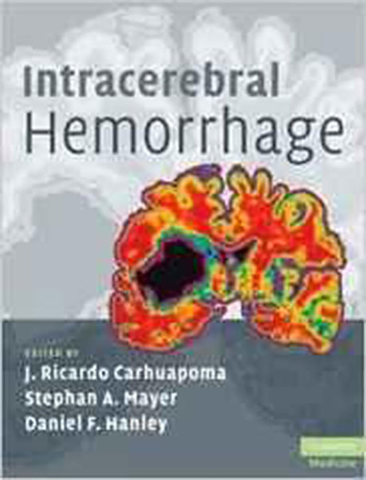 Intracerebral Hemorrhage