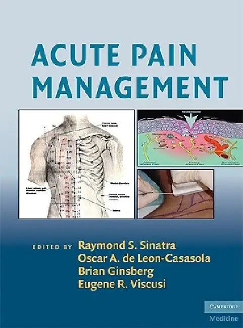 Acute Pain Management by Raymond S. Sinatra, Oscar A. de Leon-Cassasola, Eugene R. Viscusi