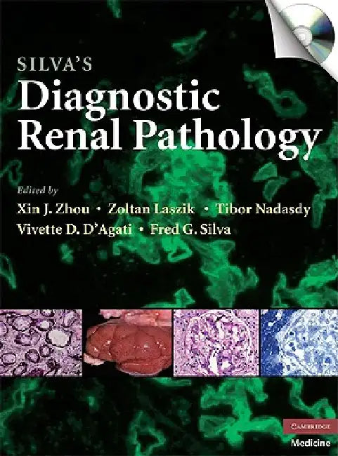 Silva's Diagnostic Renal Pathology [With CDROM] by Xin J. Zhou, Zoltan Laszik, Tibor Nadasdy