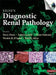 Silva's Diagnostic Renal Pathology [With CDROM] by Xin J. Zhou, Zoltan Laszik, Tibor Nadasdy