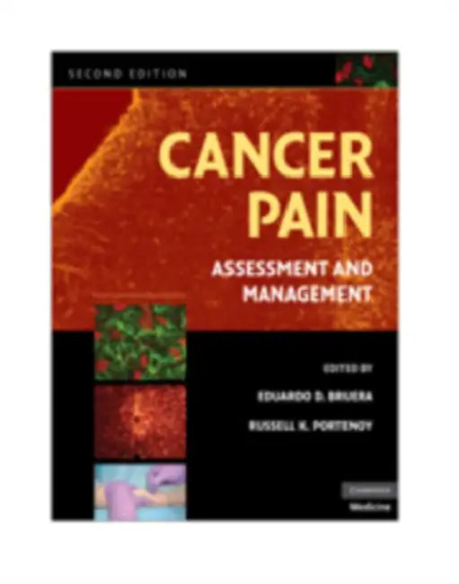 Cancer Pain by Eduardo D. Bruera, Russell K. Portenoy