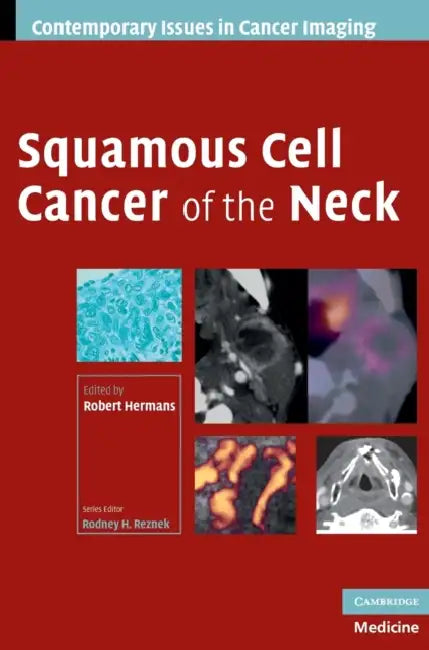 Squamous Cell Cancer of the Neck by Robert Hermans
