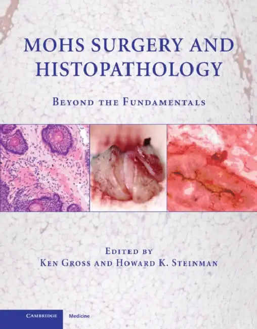 Mohs Surgery and Histopathology: Beyond the Fundamentals by Ken Gross, Howard K. Steinman