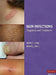 Skin Infections: Diagnosis and Treatment by John C. Hall, Brian J. Hall