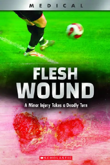 Flesh Wound! (Xbooks): A Minor Injury Takes a Deadly Turn by Shea Phillips