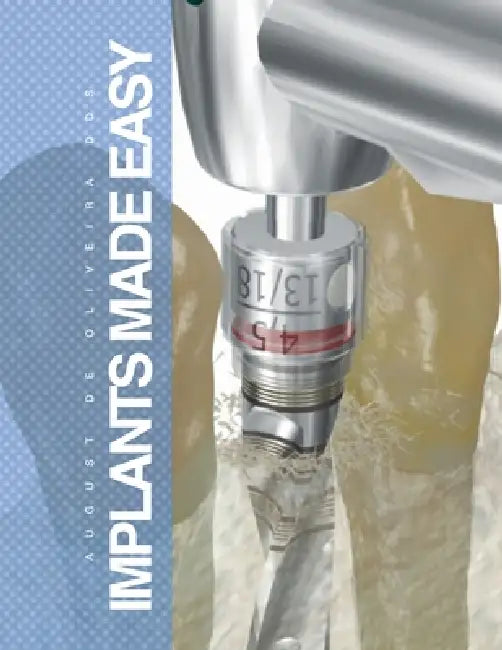 Implants Made Easy by August De Oliveira