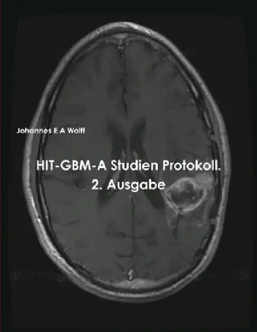 HIT-GBM-A Studien Protokoll. 2. Ausgabe by Johannes Wolff