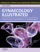 Gynaecology Illustrated by Michael Dennis