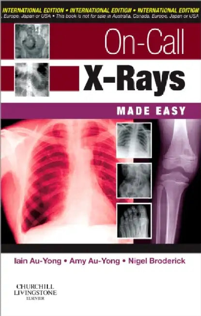 On-Call X-Rays Made Easy IE by Au-Yong