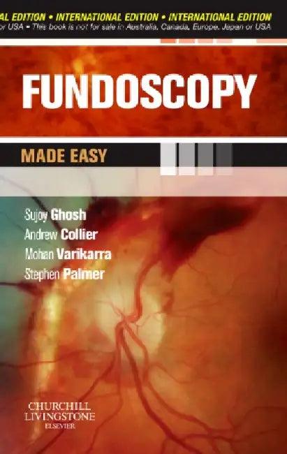 Fundoscopy Made Easy IE by Ghosh