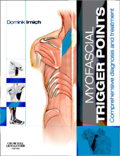 Myofascial Trigger Points by Michael L. Kurtz