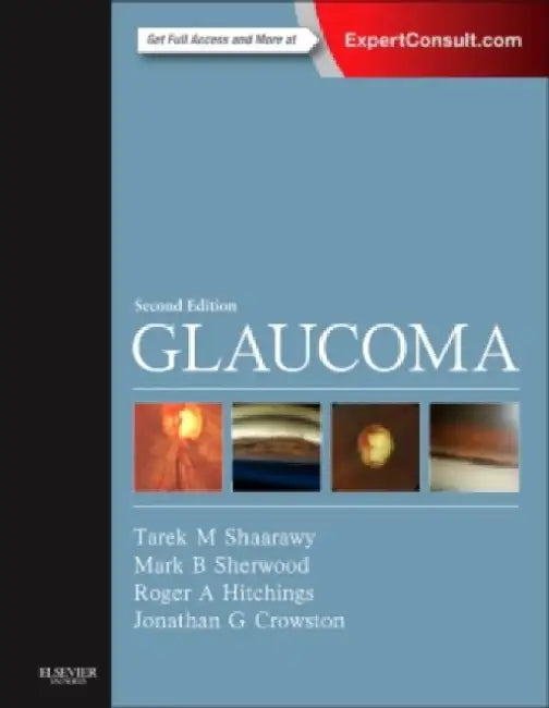 Glaucoma by Mark B. (Daniels Professor, Departments Of Ophthalmology And Cell Biology, Director Of Vision Research Center, University Of Florida, Gainesville, Fl, Usa) Sherwood
