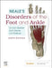 Neale's Disorders of the Foot and Ankle by J. Gordon Burrow