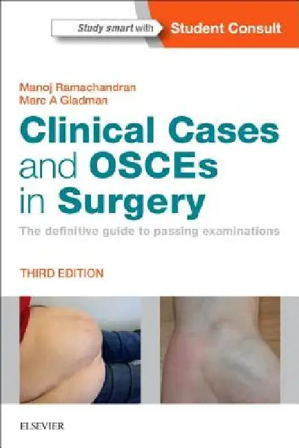 Clinical Cases and Osces in Surgery: The Definitive Guide to Passing Examinations by Manoj Ramachandran