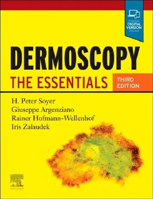 Dermoscopy: The Essentials by H. Peter Soyer