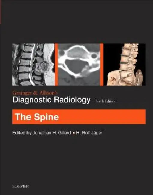 Grainger & Allison's Diagnostic Radiology: The Spine by Jonathan H. Gillard